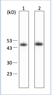 Anti-HBs, Pre-S2 mAb (Clone 88F3)