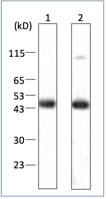 Anti-HBsAG S mAb (Clone 65C1)