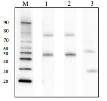 Anti Hepatitis B virus (HBV) Large Envelope Protein Pre-S1 Domain pAb (Rabbit, Purified Ig)