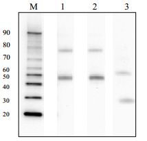 Anti Hepatitis B virus (HBV) Large Envelope Protein Pre-S2 Domain pAb (Rabbit, Purified Ig)