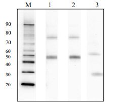 Anti Hepatitis B virus (HBV) Large Envelope Protein S Domain (HBsAg) pAb (Rabbit, Purified Ig)