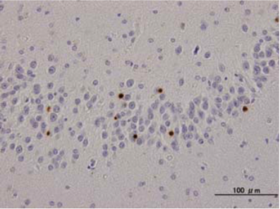 Anti TAR DNA-Binding Protein 43 (TDP-43), phospho-Ser409/410 mAb (Clone 11-9)