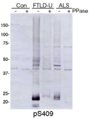 Anti TAR DNA-Binding Protein 43 (TDP-43), phospho Ser409 pAb (Rabbit, Antiserum)