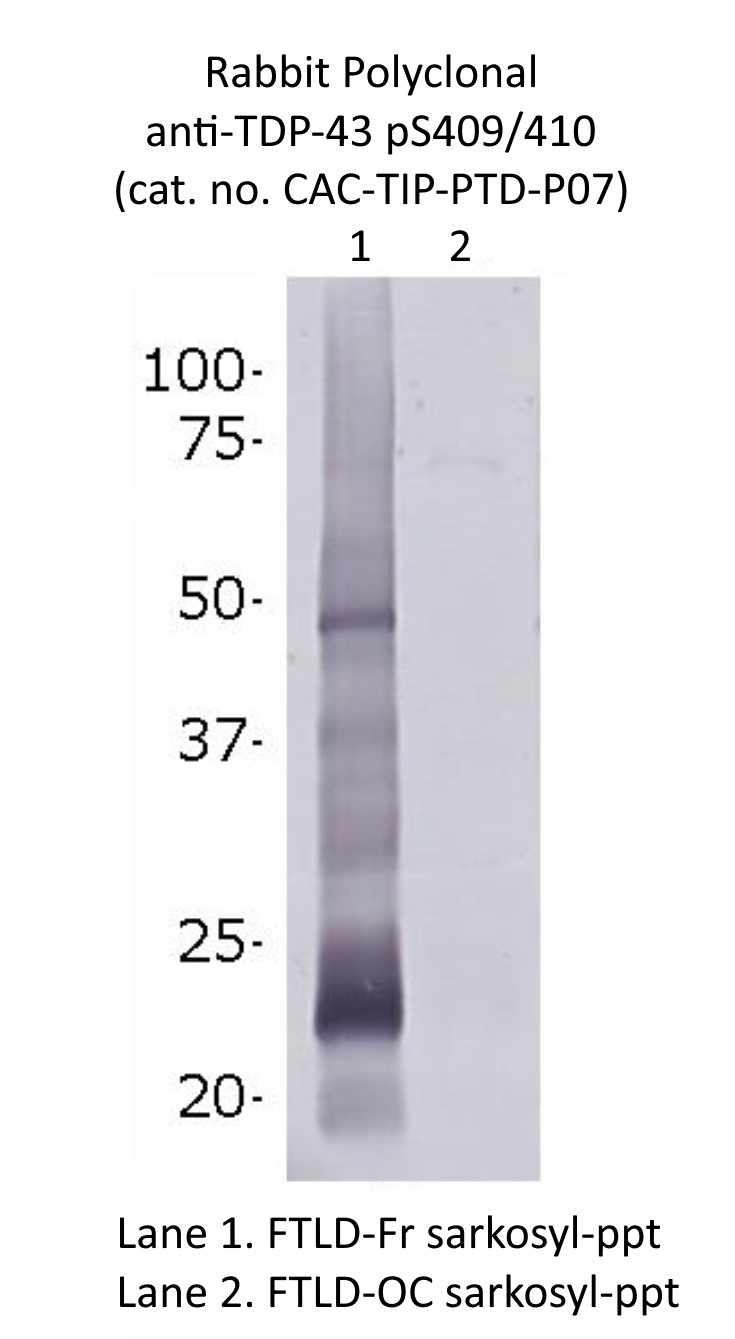 Anti phospho TDP-43 (pS409/410) pAb [replaces CAC-TIP-PTD-P01]