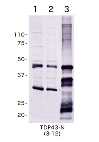 Anti TAR DNA-binding protein 43 (TDP-43) Amino Acids 3-12 pAb (Rabbit, Antiserum)