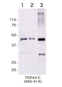 Anti TAR DNA-binding protein 43 (TDP-43) Amino Acids 405-414 pAb (Rabbit, Antiserum)