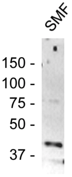 Anti Monocarboxylate transporter 2 (MCT2) pAb (Rabbit, Antiserum)