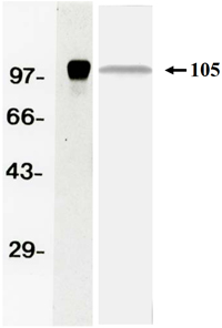 Anti Amyloid-Beta Precursor Protein (APP) mAb (Clone 278)