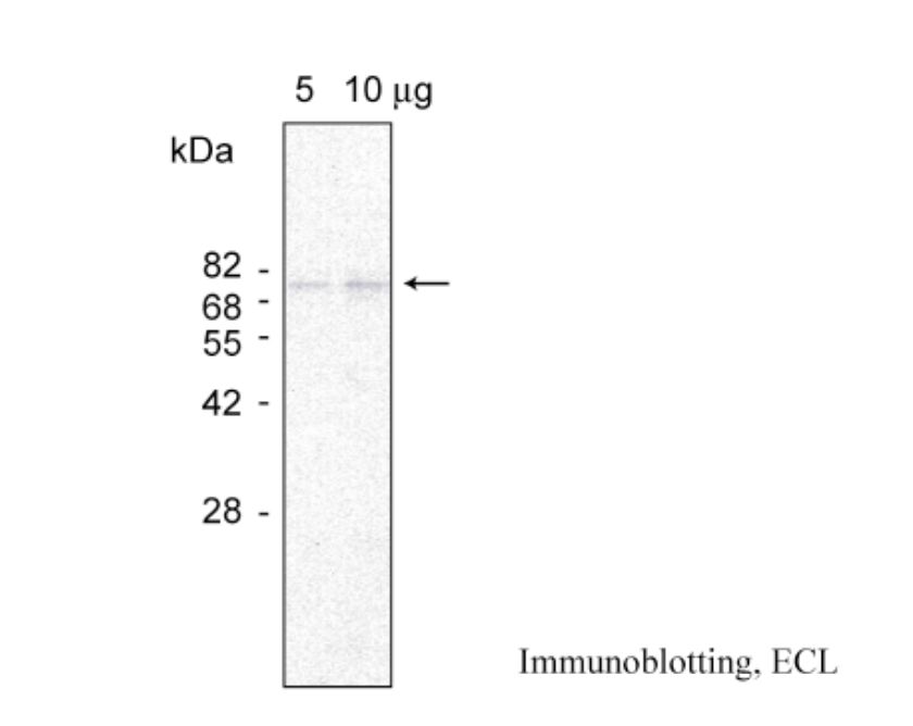 Anti Protein NRT1/PTR Family 6.2 (AJ011604) pAb (Rabbit)