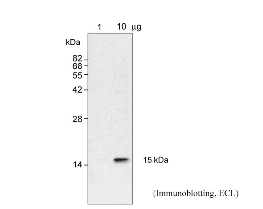 Anti Ribosomal Protein S14 pAb (Rabbit)