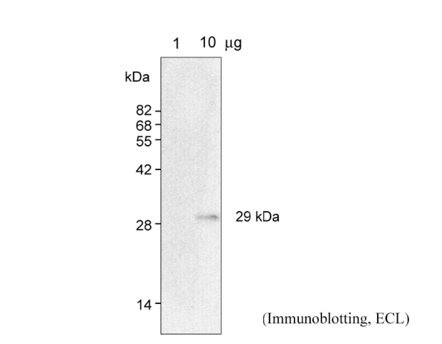 Anti Ribosomal Protein L13 pAb (Rabbit)