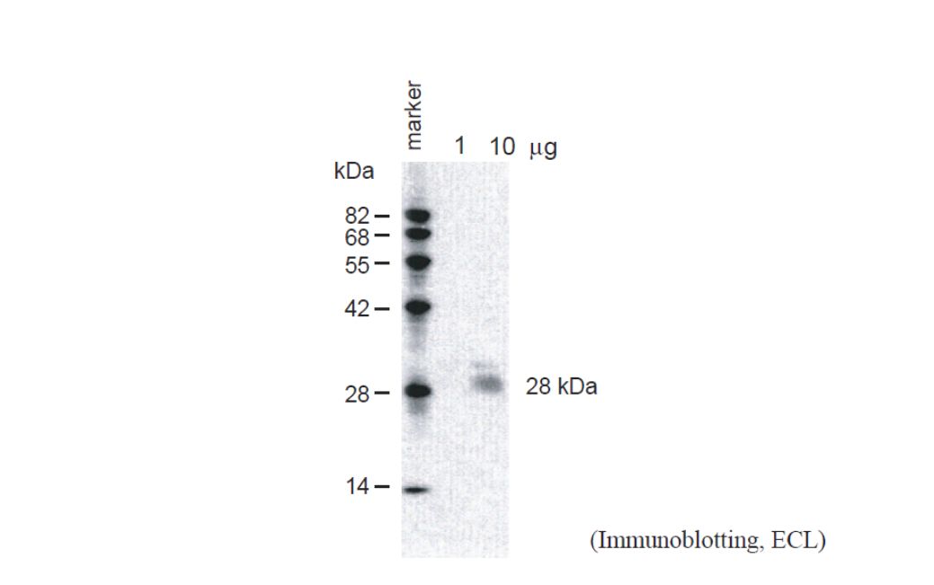 Anti Arabidopsis thaliana Aquaporin PIP2,1, PIP2,2, PIP2,3 (C-terminus) pAb (Rabbit)