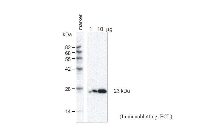 Anti Arabidopsis thaliana Aquaporin TIP1,1 and TIP1,2 Gamma (Epitope: GVQEEVTHPSALRA-Cys) pAb (Rabbit)