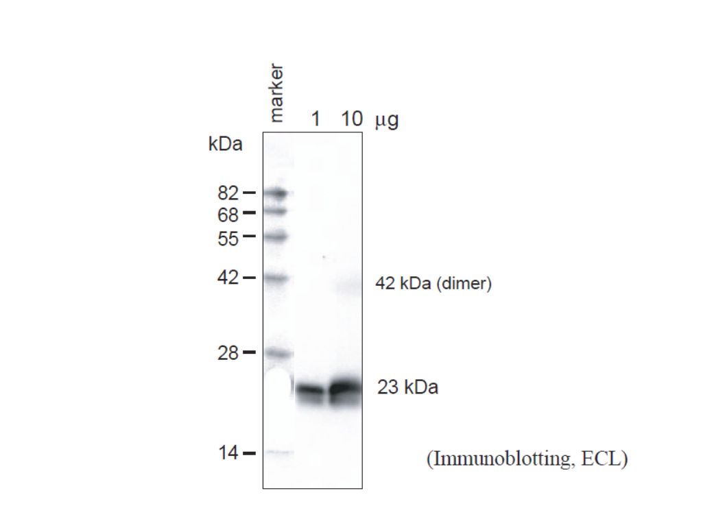 Anti Arabidopsis thaliana Aquaporin TIP1,1 & TIP1,2 Gamma (Epitope: Cys-INQNGHEQLPTTDY) pAb (Rabbit)