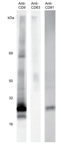 Breast Milk Exosome, Human