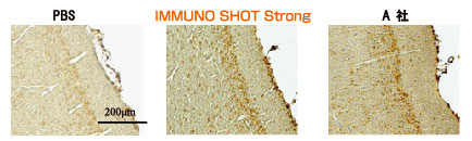 IMMUNO SHOT Immunostaining, Strong