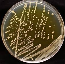 YSG Agar Plate