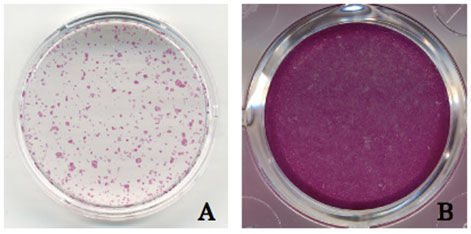 Calcified Nodule Staining kit