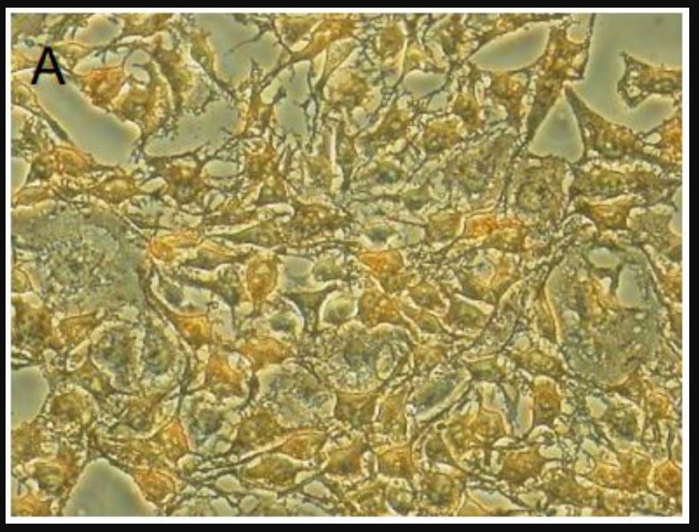 GIST-T1 Cell Line